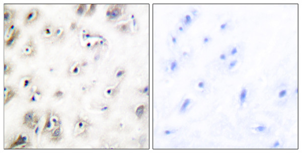 Immunohistochemistry analysis of paraffin-embedded human brain tissue, using Amylin Antibody. The picture on the right is blocked with the synthesized peptide.
