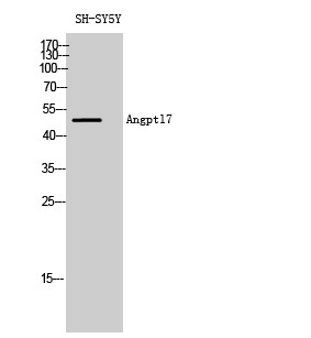 Western blot analysis of SH-SY5Y cells using Angptl7 polyclonal antibody diluted at 1:2000 STJ91594