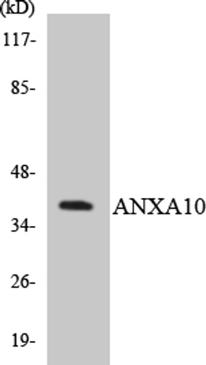 Western blot analysis of the lysates from Jurkat cells using ANXA10 antibody.