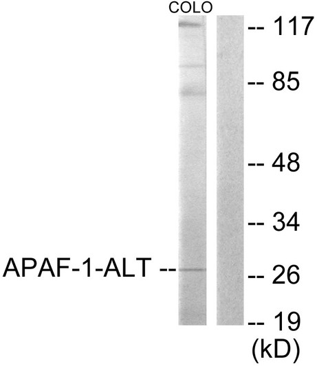 Western blot analysis of lysates from COLO205 cells, using APAF-1-ALT Antibody. The lane on the right is blocked with the synthesized peptide.