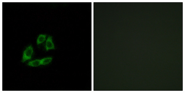 Immunofluorescence analysis of A549 cells, using ARFIP1 Antibody. The picture on the right is blocked with the synthesized peptide. Immunofluorescence analysis of A549 cells, using ARFIP1 Antibody. The picture on the right is blocked with the synthesized peptide.