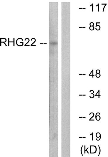 Western blot analysis of lysates from K562 cells, using RHG22 Antibody. The lane on the right is blocked with the synthesized peptide. Western blot analysis of lysates from K562 cells, using RHG22 Antibody. The lane on the right is blocked with the synthesized peptide.