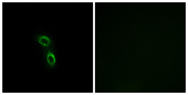 Immunofluorescence analysis of A549 cells, using ARMC6 Antibody. The picture on the right is blocked with the synthesized peptide.
