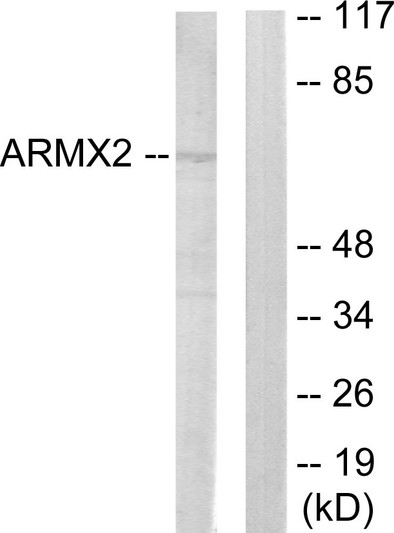 Western blot analysis of lysates from 293 cells, using ARMCX2 Antibody. The lane on the right is blocked with the synthesized peptide.