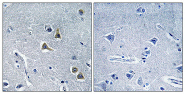 Immunohistochemical analysis of paraffin-embedded Human brain. Antibody was diluted at 1:100 (4°C overnight). High-pressure and temperature Tris-EDTA, pH8.0 was used for antigen retrieval. Negetive contrl (right) obtaned from antibody was pre-absorbed by immunogen peptide.
