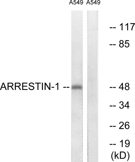 Western blot analysis of lysates from A549 cells, treated with Etoposide 25uM 60', using Arrestin 1 Antibody. The lane on the right is blocked with the synthesized peptide.
