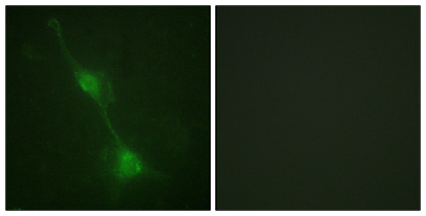 Immunofluorescence analysis of NIH/3T3 cells, using Ataxin 1 Antibody. The picture on the right is blocked with the synthesized peptide.