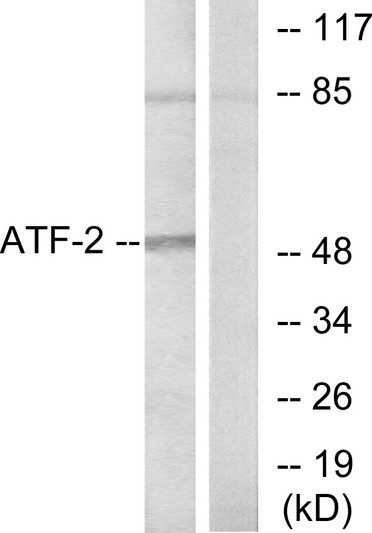 Western blot analysis of lysates from HeLa cells, using ATF2 Antibody. The lane on the right is blocked with the synthesized peptide.