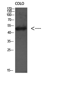 Western Blot analysis of Colo using antibody diluted at 1:1000. Secondary antibody was diluted at STJ91761