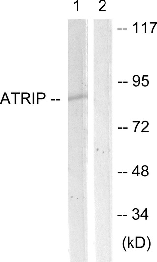 Western blot analysis of lysates from NIH/3T3 cells, using ATRIP Antibody. The lane on the right is blocked with the synthesized peptide.