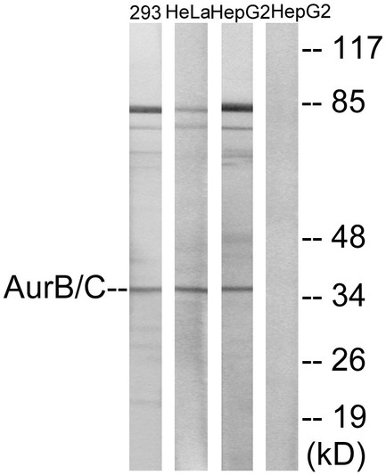 Western blot analysis of lysates from 293, HeLa, and fHepG2 cells, treated with Paclitaxel 1uM 24h, using AurB/C Antibody. The lane on the right is blocked with the synthesized peptide.