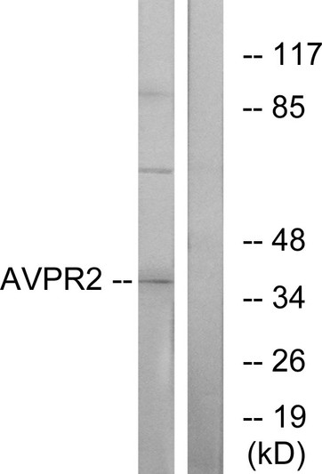 Western blot analysis of lysates from RAW264.7 cells, using AVPR2 Antibody. The lane on the right is blocked with the synthesized peptide.