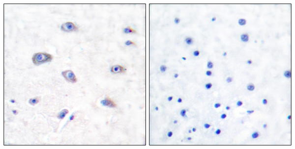 Immunohistochemistry analysis of paraffin-embedded human brain tissue, using BACE Antibody. The picture on the right is blocked with the synthesized peptide.