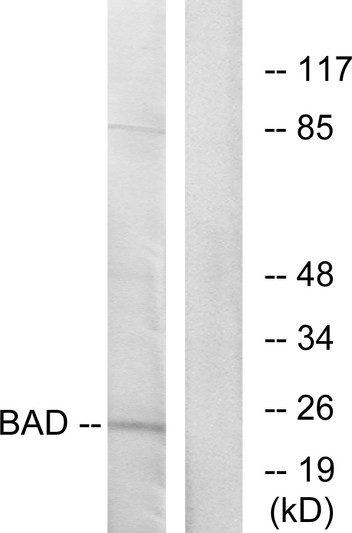 Western blot analysis of lysates from 293 cells, treated with Forskolin, using BAD Antibody. The lane on the right is blocked with the synthesized peptide.