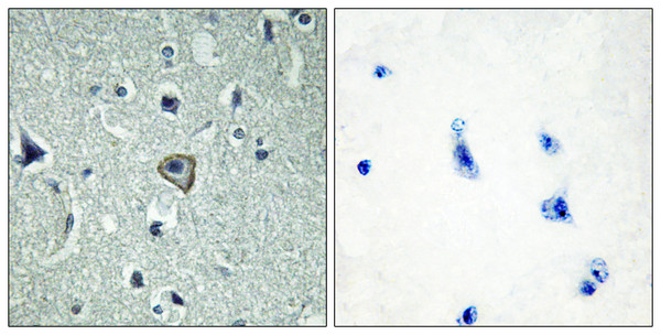 Immunohistochemistry analysis of paraffin-embedded human brain tissue, using BAI2 Antibody. The picture on the right is blocked with the synthesized peptide.
