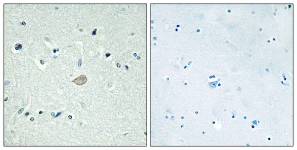 Immunohistochemistry analysis of paraffin-embedded human brain tissue, using BAI3 Antibody. The picture on the right is blocked with the synthesized peptide. Immunohistochemistry analysis of paraffin-embedded human brain tissue, using BAI3 Antibody. The picture on the right is blocked with the synthesized peptide.
