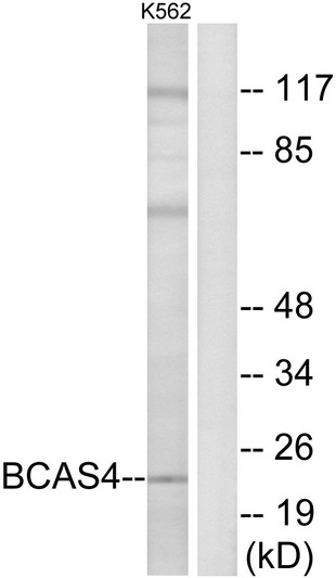 Western blot analysis of lysates from K562 cells, using BCAS4 Antibody. The lane on the right is blocked with the synthesized peptide.