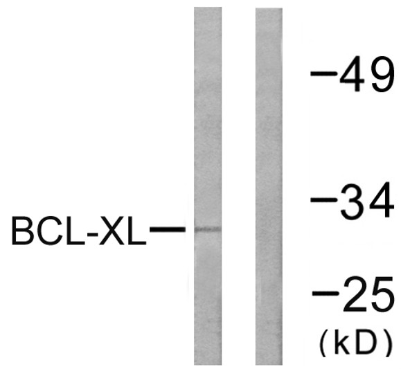 Western blot analysis of lysates from 293 cells, treated with UV 30', using BCL-XL Antibody. The lane on the right is blocked with the synthesized peptide.