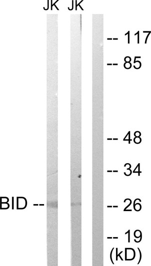 Western blot analysis of lysates from Jurkat cells treated with H2O2 100uM 30', using BID Antibody. The lane on the right is blocked with the synthesized peptide.