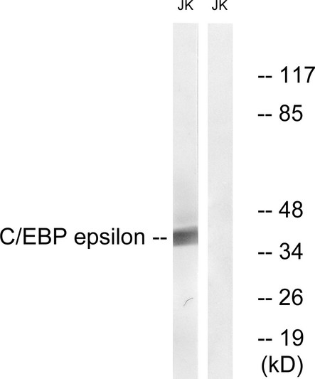 Western blot analysis of lysates from JurKat cells, treated with Insulin 0.01U/ml 15', using C/EBP-epsilon Antibody. The lane on the right is blocked with the synthesized peptide. Western blot analysis of lysates from JurKat cells, treated with Insulin 0.01U/ml 15', using C/EBP-epsilon Antibody. The lane on the right is blocked with the synthesized peptide.
