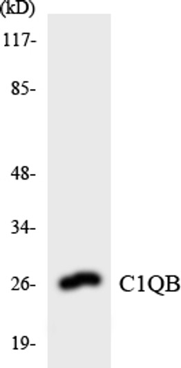 Western blot analysis of the lysates from Jurkat cells using C1QB antibody.