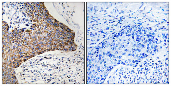 Immunohistochemistry analysis of paraffin-embedded human tonsil tissue, using C1QBP Antibody. The picture on the right is blocked with the synthesized peptide.