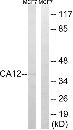 Western blot analysis of lysates from MCF-7 cells, using CA12 Antibody. The lane on the right is blocked with the synthesized peptide. Western blot analysis of lysates from MCF-7 cells, using CA12 Antibody. The lane on the right is blocked with the synthesized peptide.