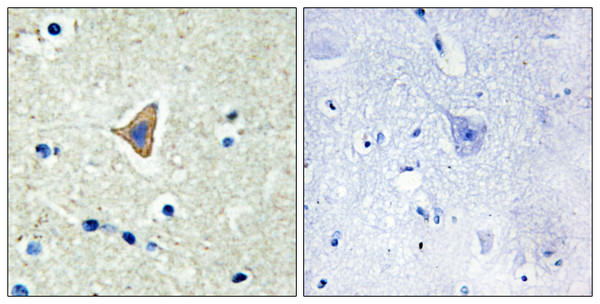 Immunohistochemistry analysis of paraffin-embedded human brain tissue, using CDH20 Antibody. The picture on the right is blocked with the synthesized peptide.