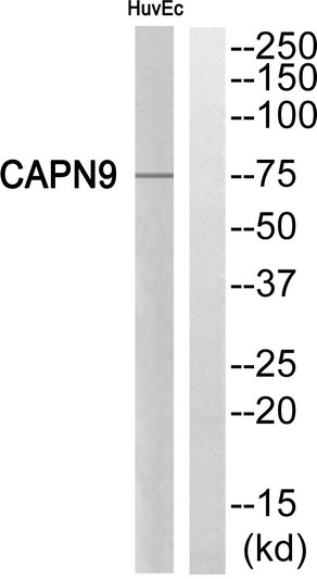 Western blot analysis of CAPN9 Antibody. The lane on the right is blocked with the CAPN9 peptide.