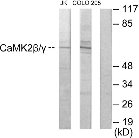 Western blot analysis of lysates from COLO205 and Jurkat cells, using CaMK2 beta/gamma Antibody. The lane on the right is blocked with the synthesized peptide.