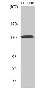 Western Blot analysis of various cells using CARD11 Polyclonal Antibody STJ92000