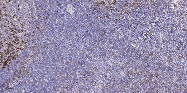 Immunohistochemical analysis of paraffin-embedded human tonsil. 1, Antibody was diluted at 1:200 (4° overnight). 2, STJ92001