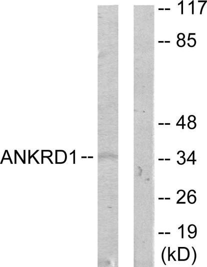 Western blot analysis of lysates from COLO205 cells, using ANKRD1 Antibody. The lane on the right is blocked with the synthesized peptide.
