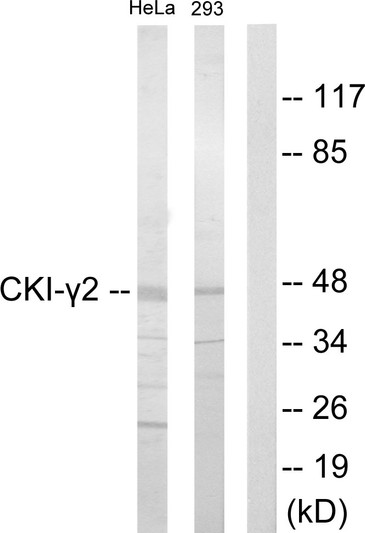 Western blot analysis of lysates from HeLa and 293 cells, using CKI-gamma2 Antibody. The lane on the right is blocked with the synthesized peptide.