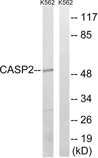 Western blot analysis of lysates from K562, using Caspase 2 Antibody. The lane on the right is blocked with the synthesized peptide.