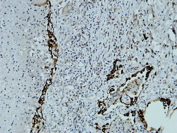 Immunohistochemical analysis of paraffin-embedded Human lung. 1, Antibody was diluted at 1:200 (4°C overnight). 2, High-pressure and temperature EDTA, pH8.0 was used for antigen retrieval. 3, Secondary antibody was diluted at 1:200 (room temperature, 30min).