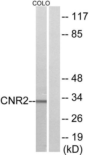 Western blot analysis of lysates from COLO205 cells, using CNR2 Antibody. The lane on the right is blocked with the synthesized peptide.