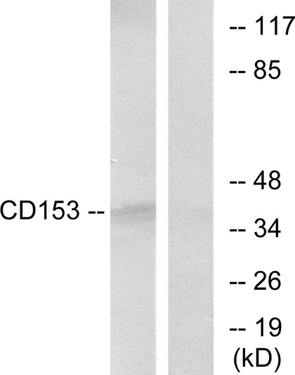 Western blot analysis of lysates from RAW264.7 cells, using CD153 Antibody. The lane on the right is blocked with the synthesized peptide.