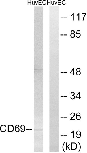 Western blot analysis of lysates from HUVEC cells, using CD69 Antibody. The lane on the right is blocked with the synthesized peptide.