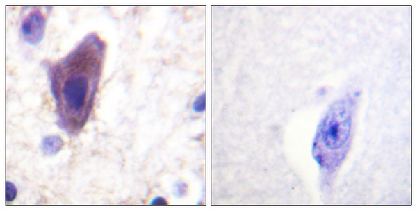 Immunohistochemistry analysis of paraffin-embedded human brain tissue, using CD71/TfR Antibody. The picture on the right is blocked with the synthesized peptide. Immunohistochemistry analysis of paraffin-embedded human brain tissue, using CD71/TfR Antibody. The picture on the right is blocked with the synthesized peptide.
