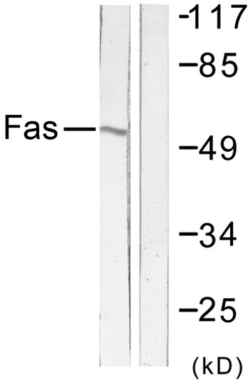Western blot analysis of lysates from LOVO cells, using FAS Antibody. The lane on the right is blocked with the synthesized peptide.