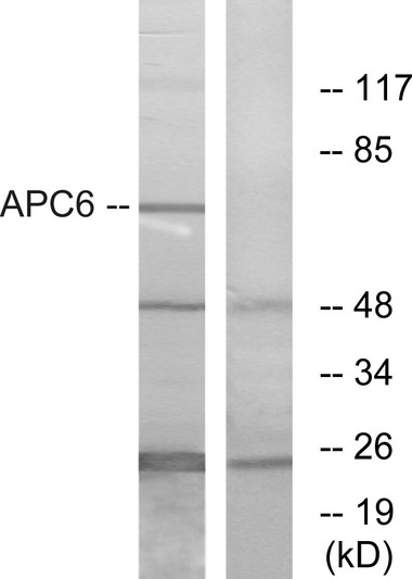 Western blot analysis of lysates from NIH/3T3 cells, using APC6 Antibody. The lane on the right is blocked with the synthesized peptide. Western blot analysis of lysates from NIH/3T3 cells, using APC6 Antibody. The lane on the right is blocked with the synthesized peptide.