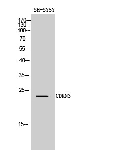 Western blot analysis of SH-SY5Y cells using CDKN3 polyclonal antibody diluted at 1:1000 STJ92208
