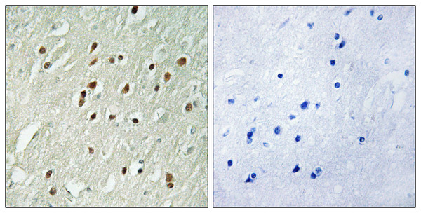 Immunohistochemistry analysis of paraffin-embedded human brain, using CNTROB Antibody. The picture on the right is blocked with the synthesized peptide. Immunohistochemistry analysis of paraffin-embedded human brain, using CNTROB Antibody. The picture on the right is blocked with the synthesized peptide.