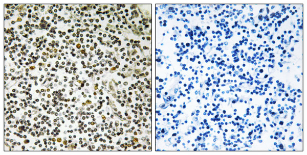 Immunohistochemistry analysis of paraffin-embedded human lymph node tissue, using CEP152 Antibody. The picture on the right is blocked with the synthesized peptide.