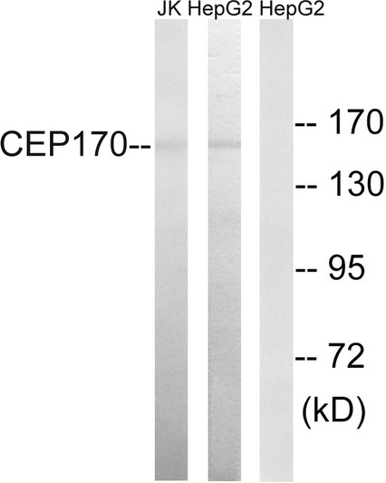 Western blot analysis of lysates from HepG2 and Jurkat cells, using CEP170 Antibody. The lane on the right is blocked with the synthesized peptide.