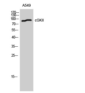 Western blot analysis of A549 cells using cGKII polyclonal antibody diluted at 1:1000 STJ92256