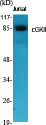 Western blot analysis of various cells using cGKII polyclonal antibody STJ92257
