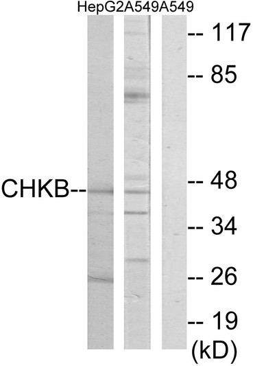 Western blot analysis of lysates from HepG2 and A549 cells, using CHKB Antibody. The lane on the right is blocked with the synthesized peptide.