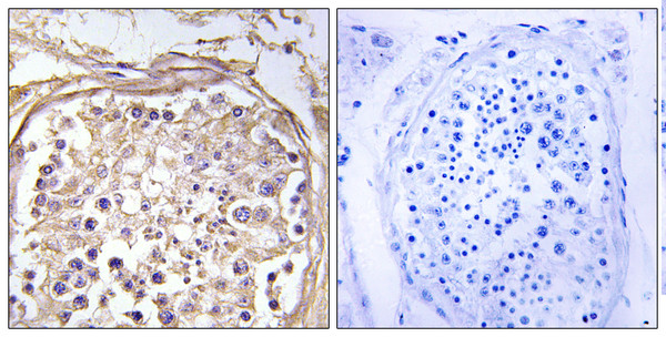 Immunohistochemistry analysis of paraffin-embedded human testis tissue, using CHST9 Antibody. The picture on the right is blocked with the synthesized peptide. Immunohistochemistry analysis of paraffin-embedded human testis tissue, using CHST9 Antibody. The picture on the right is blocked with the synthesized peptide.